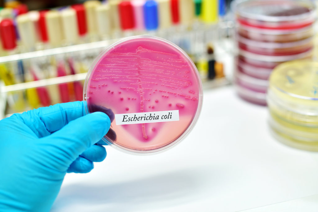 Wissenschaftler von der Harvard Medical School und dem Beth Israel Deaconess Medical Center haben jetzt versucht herauszufinden, welche Medikamente gegen antibiotikaresistente Bakterien eingesetzt werden können. Diese gefährlichen Stämme von Bakterien sind weltweit auf dem Vormarsch. (Bild: jarun011/fotolia.com)