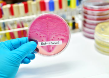 Wissenschaftler von der Harvard Medical School und dem Beth Israel Deaconess Medical Center haben jetzt versucht herauszufinden, welche Medikamente gegen Antibiotika-resistente Bakterien eingesetzt werden können. Diese gefährlichen Stämme von Bakterien sind weltweit auf dem Vormarsch. (Bild: jarun011/fotolia.com)