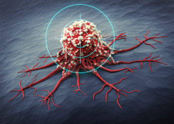 Mediziner entdeckten jetzt ein Protein, dass bei sogenannten körpereigenen Killerzellen die Aktivität hemmt. Wenn diese "Bremse" etnfernt wird, bekämpfen die Zellen noch effektiver vorhandenen Krebs. (Bild: psdesign1/fotolia.com)