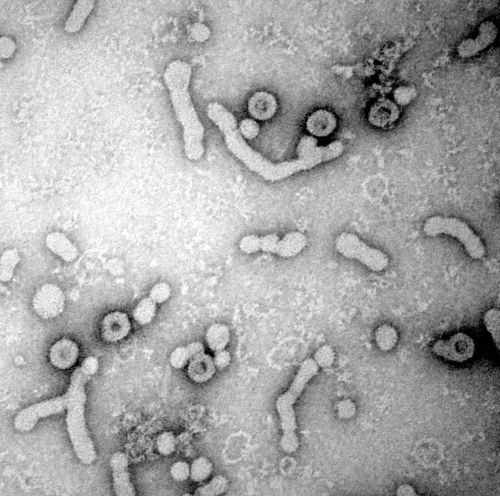 Hepatitis-B-Viren sind bei der Infektion von Zellen dnk eines speziellen Mechanismus besonders effektiv. (Bild: Universitätsklinikum Heidelberg / S.Seitz)