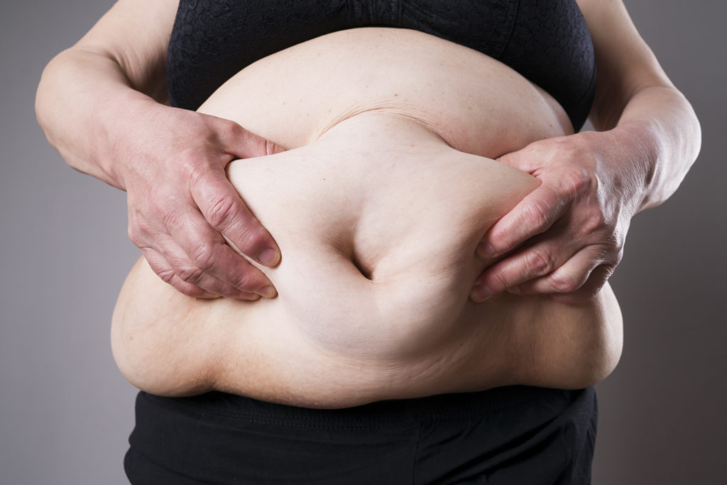 Übergewicht und Fettleibigkeit steigern unser Risiko an Multiple Sklerose zu erkranken. Achten Sie also immer auf einen gesunden Body-Mass-Index, um die Gefahr einer Erkrankung durch MS zu verhindern. (Bild: staras/fotolia.com)