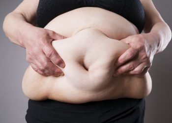 Übergewicht und Fettleibigkeit steigern unser Risiko an Multiple Sklerose zu erkranken. Achten Sie also immer auf einen gesunden Body-Mass-Index, um die Gefahr einer Erkrankung durch MS zu verhindern. (Bild: staras/fotolia.com)