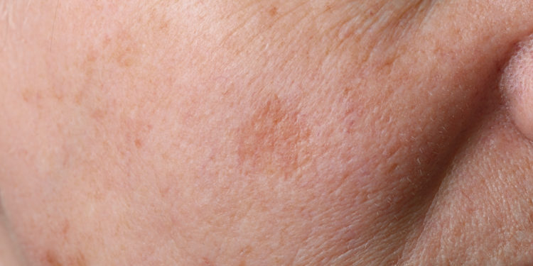 Hautzellen-Nase: Riechen wir auch mit der Haut? – Heilpraxis