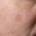 Forscher haben olfaktorische Rezeptoren (Riechrezeptoren) in Hautzellen entdeckt. (Bild: fpic/fotolia.com)