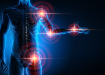 Wissenschaftler entdecken neuen Ansatz zur Behandlung chronischer Schmerzen. (Bild: psdesign1/fotolia.com)
