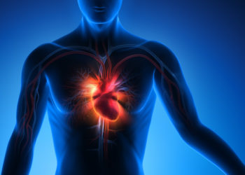 Eine Herzmuskelhypertrophie kann lebensbedrohliche Folgen wie eine Herzschwäche oder einen Herzinfarkt haben. (Bild: psdesign1/fotolia.com)