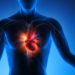 Eine Herzmuskelhypertrophie kann lebensbedrohliche Folgen wie eine Herzschwäche oder einen Herzinfarkt haben. (Bild: psdesign1/fotolia.com)