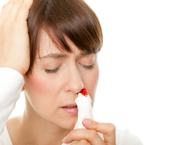 Häufiges Nasenbluten – Ursachen, Therapie und Symptome – Heilpraxis