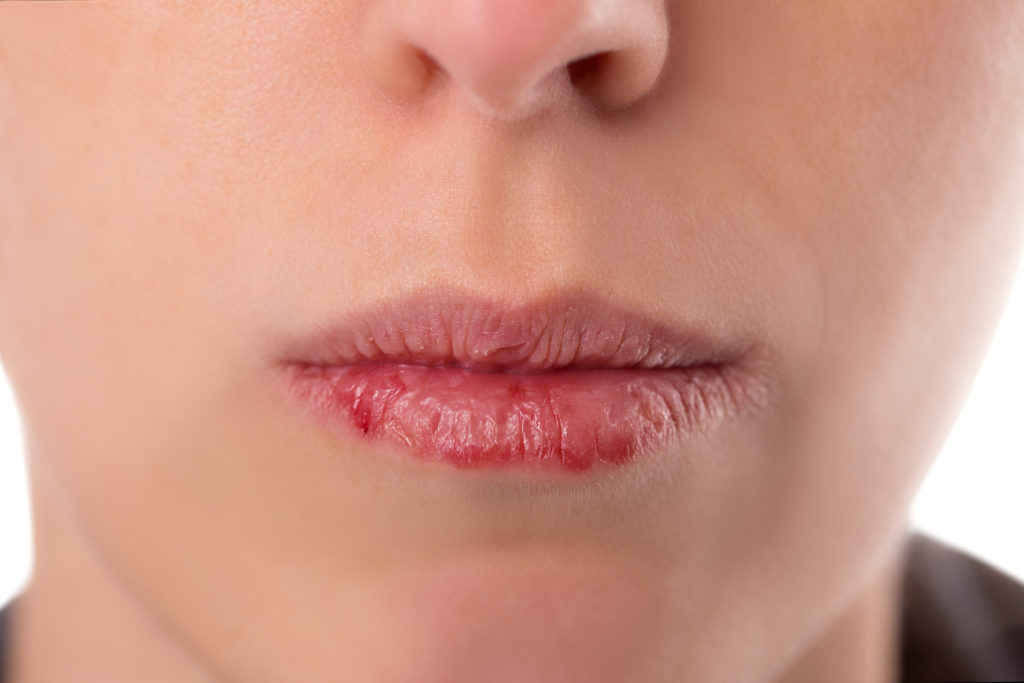 Trockenen Mund mit zuckerfreiem Bonbon begegnen. Bild: Miriam Dörr - fotolia