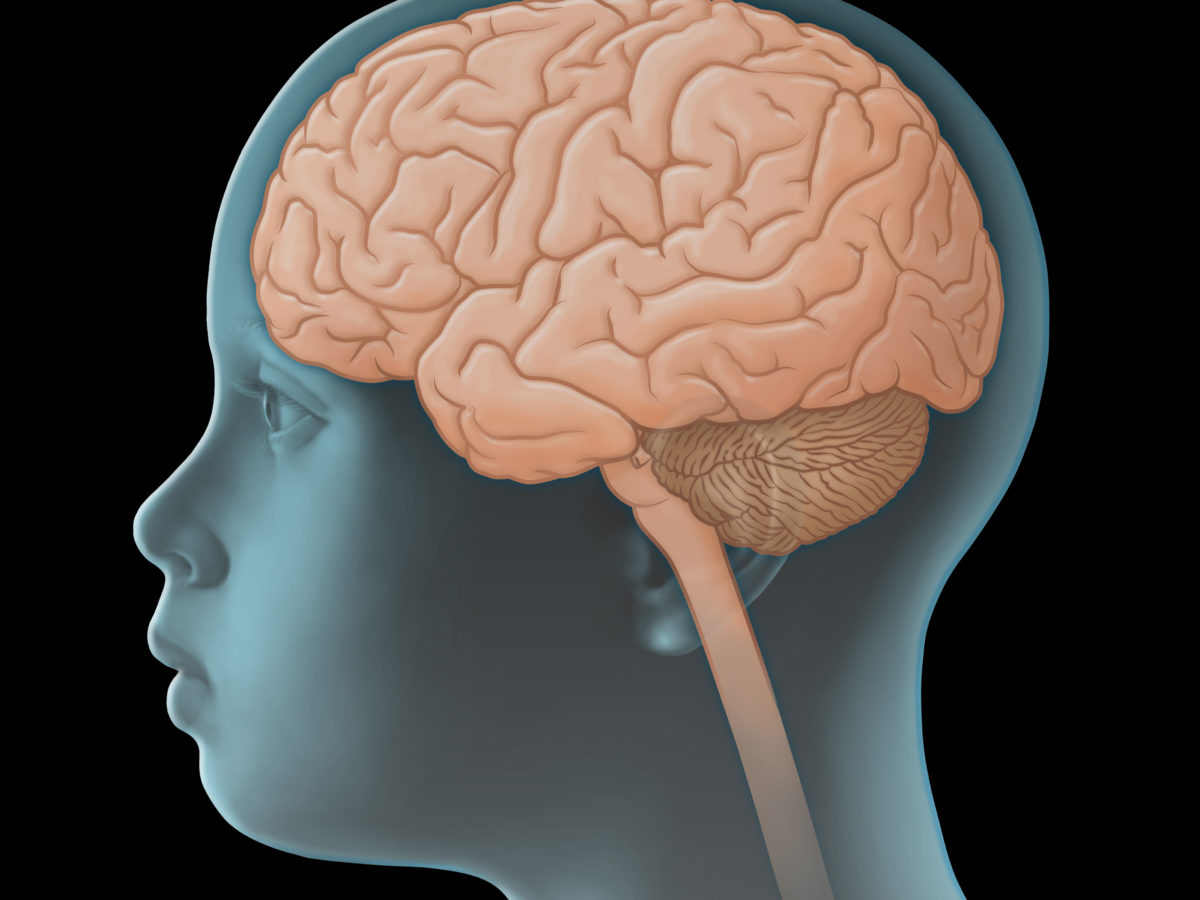 Alzheimer Genvariante Verandert Das Gehirn Schon In Der Kindheit Heilpraxis