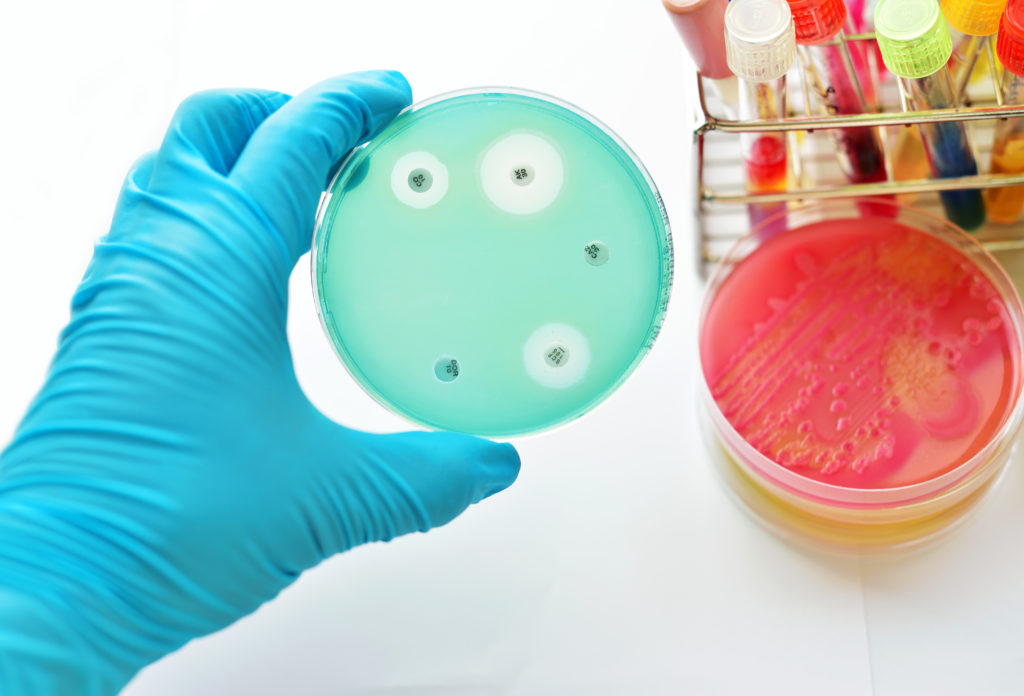 Antibiotikaresistente Keime sind ein erhebliches Problem in der Medizin, doch haben Forscher hier nun einen möglichen neuen Ansatzpunkt zur Behandlung entsprechender Infektionen entdeckt. (Bild: jarun011/fotolia.com)