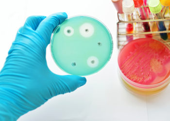 Antibiotikaresistente Keime sind ein erhebliches Problem in der Medizin, doch haben Forscher hier nun einen möglichen neuen Ansatzpunkt zur Behandlung entsprechender Infektionen entdeckt. (Bild: jarun011/fotolia.com)