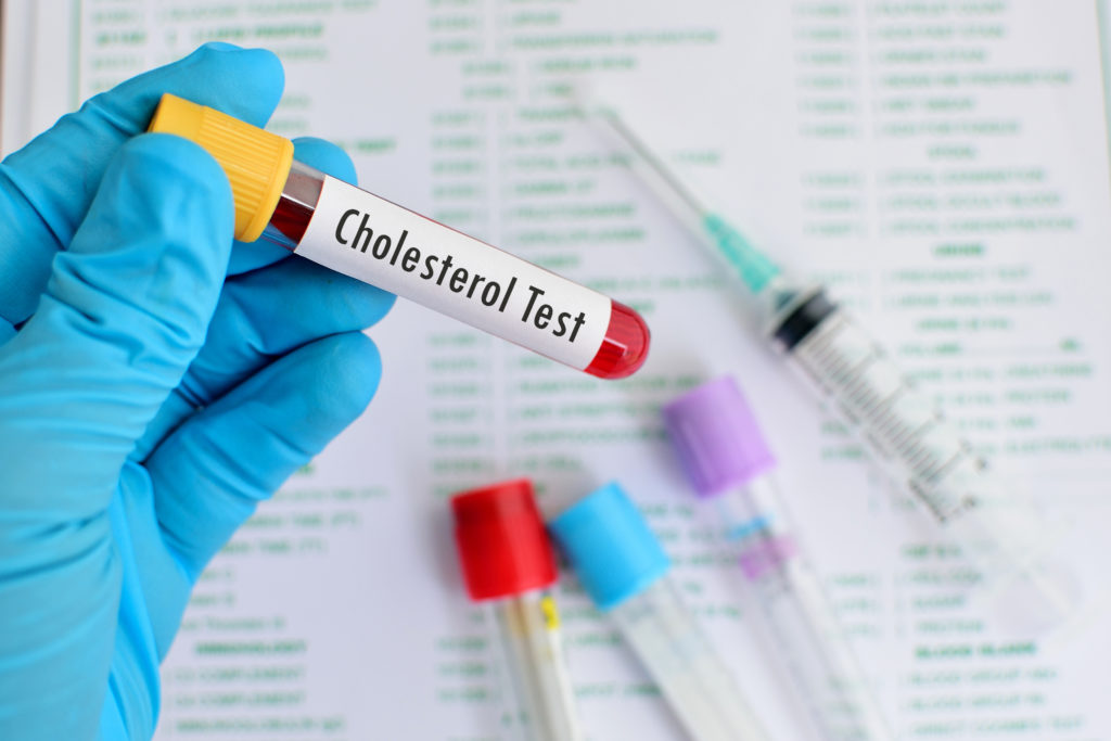 Patienten mit hohen Cholesterinwerten nehmen häufig Medikamente, um ihre Werte wieder zu senken. Solche Arzneimittel haben offenbar einen weiteren positiven Effekt. Laut Forschern könnten sie die Krebssterblichkeit senken. (Bild: jarun011/fotolia.com) 