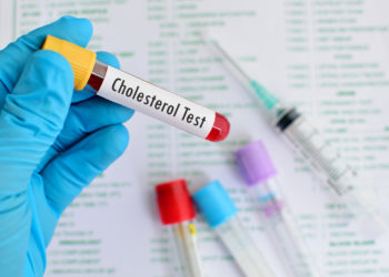 Manche Menschen, deren Cholesterin zu hoch ist, nehmen Cholesterinsenker. Doch diese Medikamente wirken nicht bei allen Patienten gleich. Das könnte damit zu tun haben, dass das Darmmikrobiom sich bei den Individuen unterscheidet. (Bild: jarun011/fotolia.com)