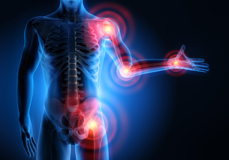 Geheimtipp Gegen Rheuma? Fda Lässt Vagusstimulator Zur Behandlung Der Rheumatoiden Arthritis Zu – Insiderwissen! - 8dr1p07