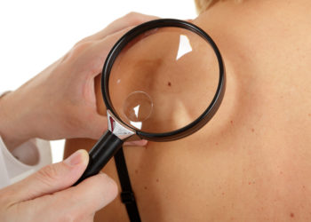 Bei Hautkrebs ist vor allem die frühzeitige Erkennung wichtig.  (Bild: fovito/fotolia.com)