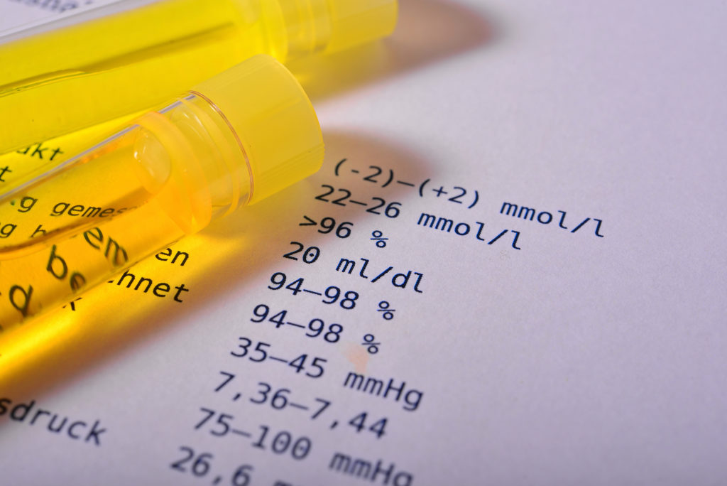 Sommerliche Hitze kann die Bildung von Nierensteinen fördern. Bild: sonne_fleckl - fotolia