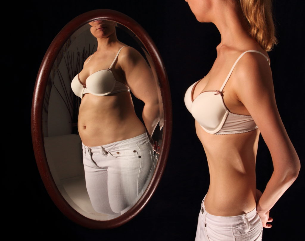 Essstörungen in Form der Magersucht gehen meist mit einer gestörten Selbstwahrnehmung einher und Betroffene empfinden sich trotz Untergewicht als zu dick. Werden Anzeichen eine Essstörung festgestellt, sollte Betroffene vorsichtig darauf.angesprochen werden. (Bild: RioPatuca Images/fotolia.com)