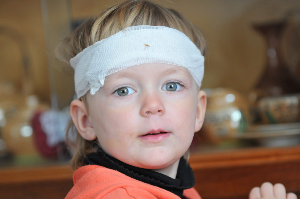 Gerade bei Kindern sind Gehirnerschütterungen und Kopfverletzungen besonders häufig. Forscher stellten jetzt fest, dass solche Verletzungen ernsthafte Spätfolgen haben können. (Bild: jörn buchheim/fotolia.com)
