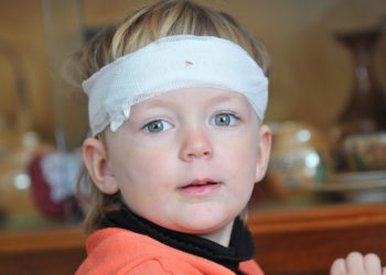 Gerade bei Kinder sind Gehirnerschütterungen und Kopfverletzungen besonders häufig. Forscher stellten jetzt fest, dass solche Verletzungen ernsthafte Spätfolgen haben können. (Bild: jörn buchheim/fotolia.com)