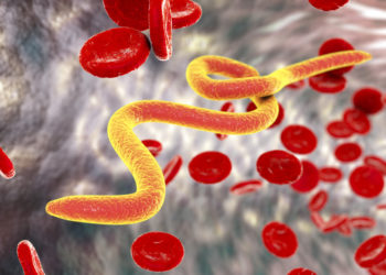 Infektionen mit den Fadenwürmern der Gattung Wuchereria bancrofti erhöhen das Risiko einer HIV-Ansteckung. (Bild: Dr_Kateryna/fotolia.com)