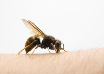 Gesundheitsexperten warnen davor, Bienen- und Wespenstiche zu unterschätzen. Bei Allergikern können sie mitunter lebensbedrohliche Folgen haben. (Bild: jcwait/stock.adobe.com)