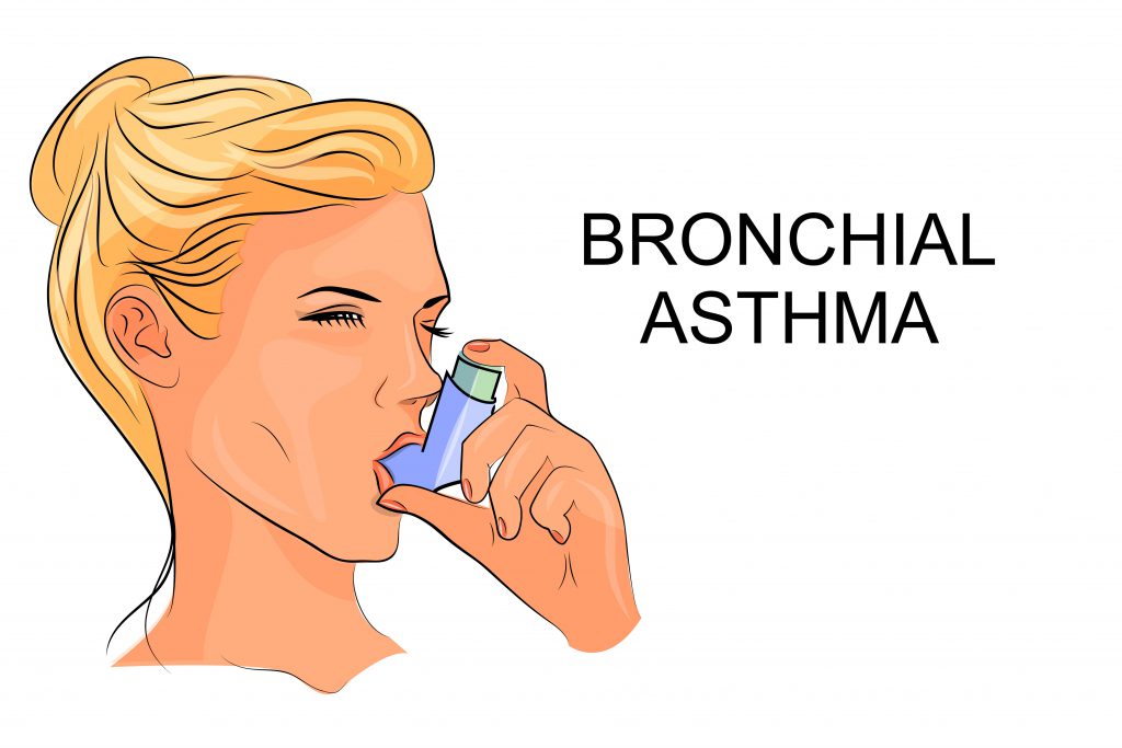 Akute Atemnot ist ein Symptom eines Asthma-Anfalls. Bild: Artemida-psy - fotolia