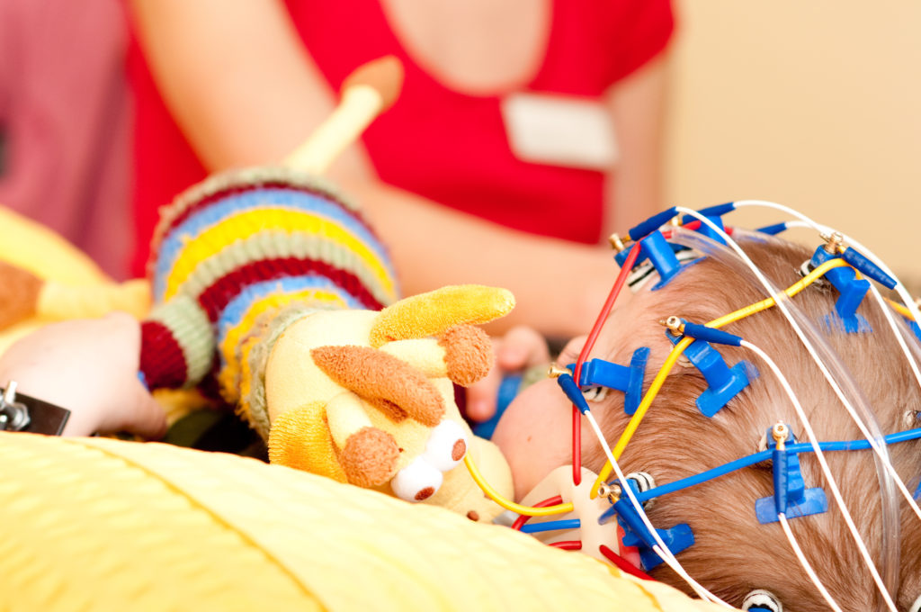 Eine Mutter in Großbritannien musste ihre dreijährige Tochter bereits über 20 Mal wiederbeleben. Das Mädchen leidet am "Dravet-Syndrom", einer seltenen Epilepsieform. (Bild: Tobilander/fotolia.com)