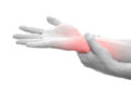 Das Karpaltunnelsydrom ist gekennzeichnet durch Missempfindungen und Schmerzen, die von der Hand bis weit den Arm hinauf ausstrahlen können. (Bild: SENTELLO/fotolia.com)