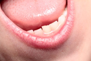 Zungenbeläge: Was sagt die Zunge über unsere Gesundheit aus? – Heilpraxis