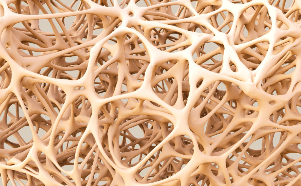 Osteoporose führt zu einer Verminderung der Knochendichte. Dadurch haben Betroffene ein erhöhtes Risiko für die Entstehung von Frakturen. Ein Bericht zeigt jetzt die Versorgungslücken bei der Behandlung von Osteoporose. (Bild: adimas/fotolia.com)