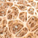 Osteoporose führt zu einer Verminderung der Knochendichte. Dadurch haben Betroffene ein erhöhtes Risiko für die Entstehung von Frakturen. Ein Bericht zeigt jetzt die Versorgungslücken bei der Behandlung von Osteoporose. (Bild: adimas/fotolia.com)