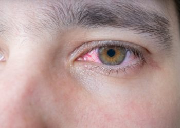 In Indien haben Ärzte einem Mann einen 15 Zentimeter langen Wurm aus dem Auge entfernt. Der Parasit musste beim Herausziehen am Leben bleiben. (Bild: vchalup/fotolia.com)
