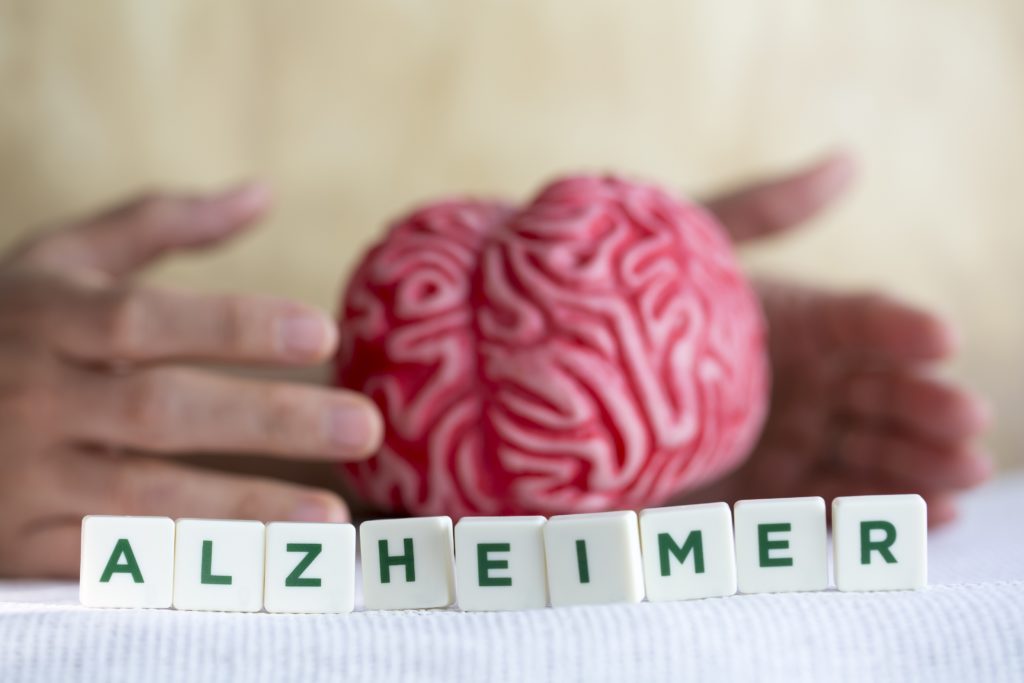 Mediziner suchen schon lange nach den Ursprüngen von Alzheimer-Erkrankungen. Jetzt entdeckten Wissenschaftler, dass Entzündungen im Gehirn eine wichtige Rolle bei der Entwicklung und Progression von Alzheimer spielen. (Bild: aytuncoylum/fotolia.com)