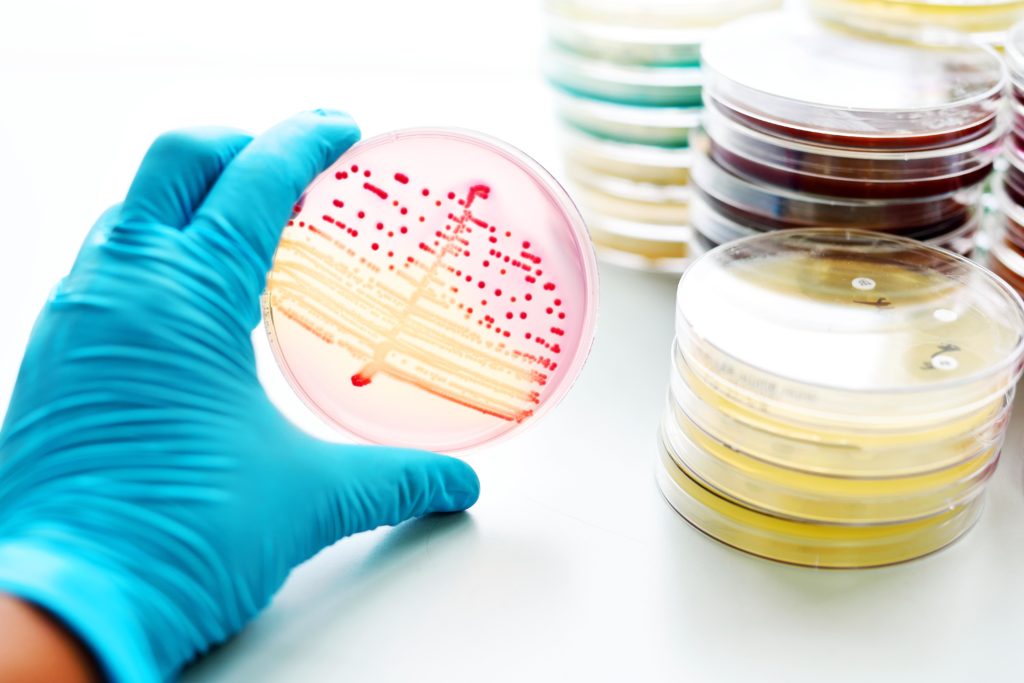Extrem resistente Darmbakterien, gegen die selbst Reserveantibiotika nicht helfen, breiten sich laut einer aktuellen Studie immer weiter aus. (Bild: jarun011/fotolia.com)