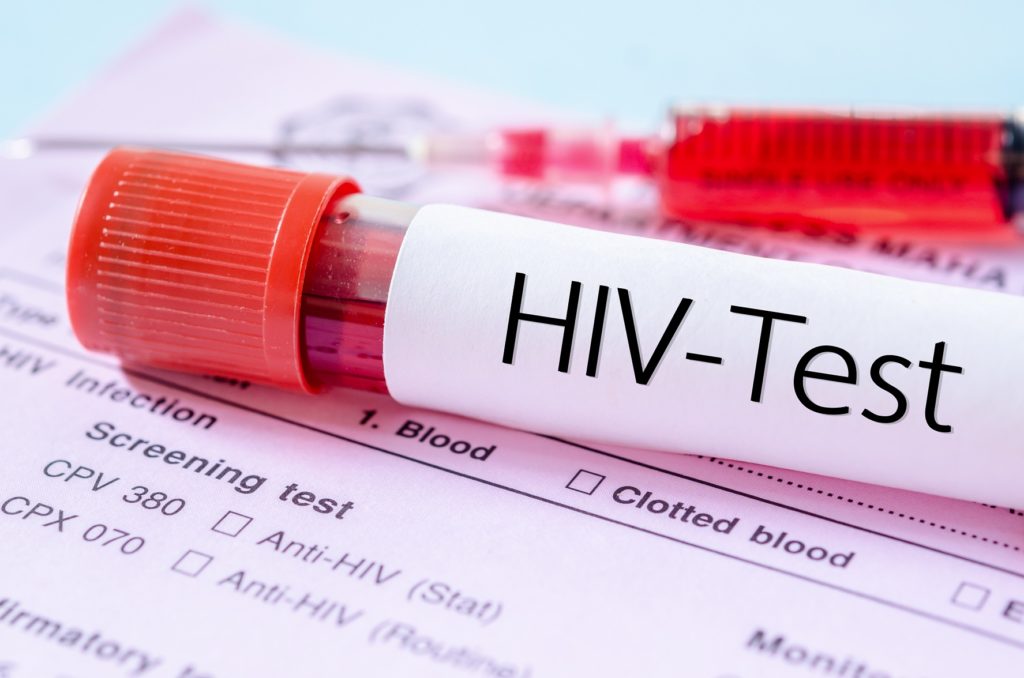 Experten warnen: Noch immer stecken sich viele - vor allem jüngere - Menschen mit dem HI-Virus an. (Bild: gamjai/fotolia.de)