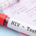 Viel zu wenig mutmaßlich Infizierte unterziehen sich einem HIV-Test (gamjai/fotolia.com)