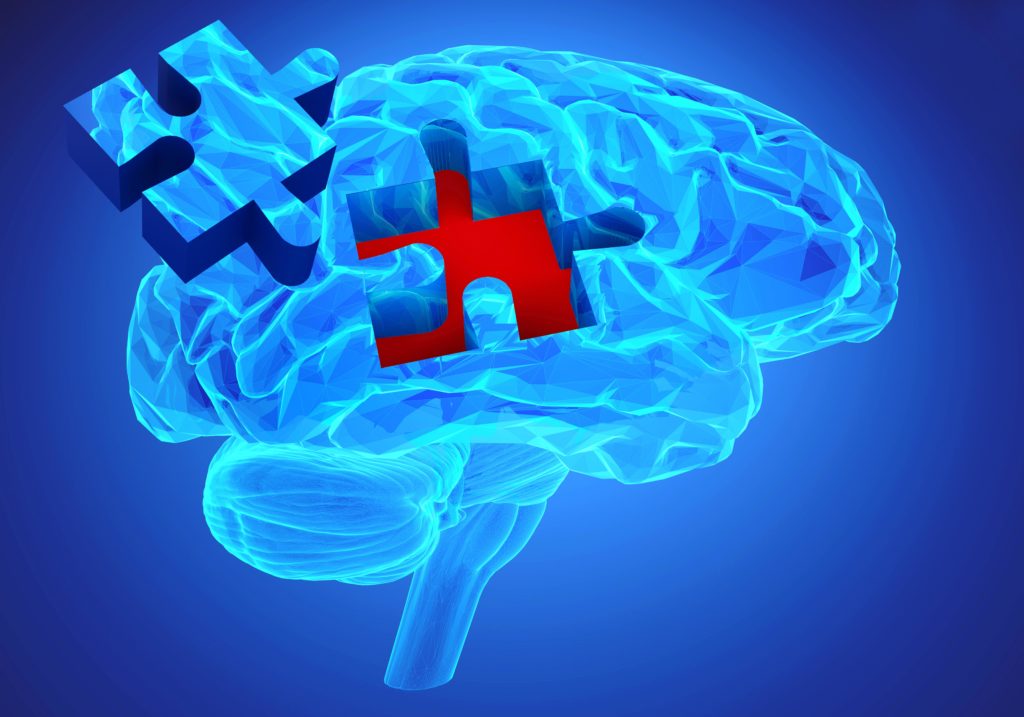 Schon Jahre vor dem Auftreten erster Symptome zeigt sich bei Alzheimer eine veränderte Immunreaktion im Gehirn, die anhand bestimmter Proteine im Nervenwasser festgestellt werden kann. (Bild: goa novi/fotolia.com)