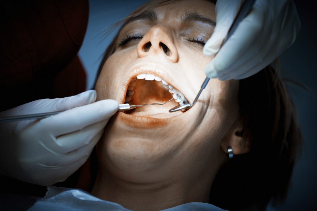 Die Europäische Union will Zahnfüllungen mit Amalgam wegen des giftigen Quecksilbers deutlich zurückdrängen. Künftig sollen Kinder sowie schwangere und stillende Frauen Amalgam nur noch in Ausnahmefällen bekommen. (Bild: sivivolk/fotolia.com)