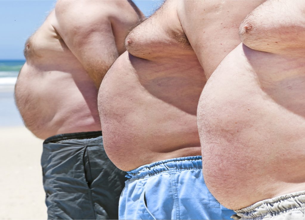 Wenn Männer Brüste bekommen, ist häufig Übergewicht die Ursache. Doch auch manche Medikamente können dazu führen. In den USA haben daher nun Tausende Männer eine Klage gegen ein Pharmaunternehmen eingereicht. (Bild: MartesiaBezuidenhout/fotolia.com)