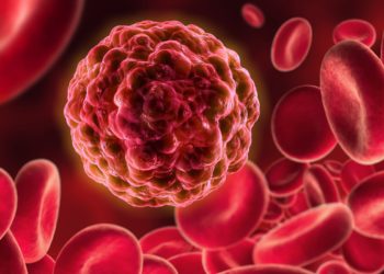 Die Behandlung von Leukämie könnte durch eine neue Untersuchung einen großen Schritt nach vorne gemacht haben. Eine Behandlung mit modifizierten Immunzellen führte zu interessanten Ergebnissen. (Bild: psdesign1/fotolia.com)