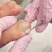 Behandlung eines verdickten Zehennagels. Bild: mafffi-fotolia