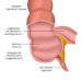 Der Wurmfortsatz ist ein unwichtiges Organ, das Ärzte häufig entfernen (bilderzwerg/fotolia.com)