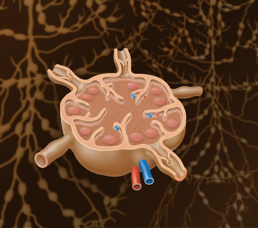 Verschiebbar lymphknoten Lymphknoten in