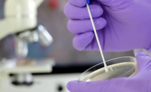 Brauner Ausfluss – Ursachen, Symptome und Therapie – Heilpraxis