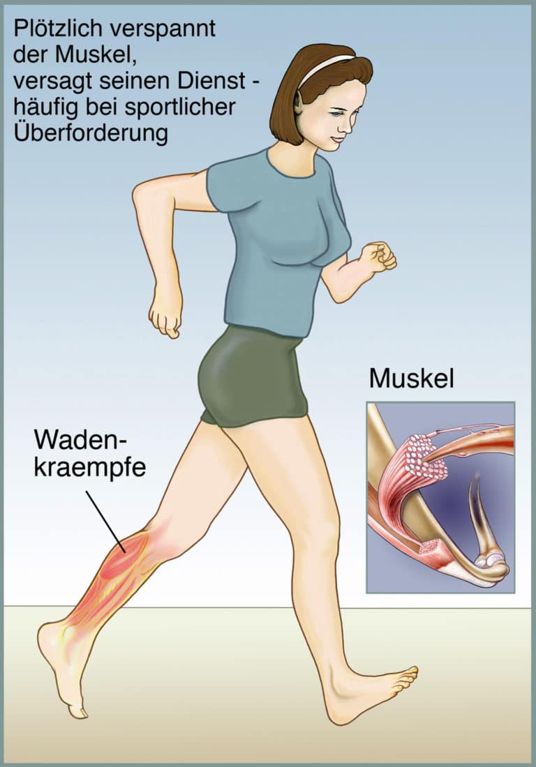 Muskelschwäche – Ursachen, Symptome und Therapie – Heilpraxis
