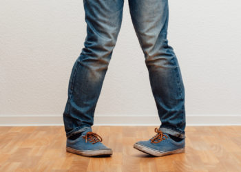 Sogenannte X-Beine sind nicht nur unter ästethischen Gesichtspunkten unangenehm, sie können auch zu Folgebeschwerden führen. (Bild: MichaelJBerlin/fotolia.com)