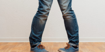 Sogenannte X-Beine sind nicht nur unter ästethischen Gesichtspunkten unangenehm, sie können auch zu Folgebeschwerden führen. (Bild: MichaelJBerlin/fotolia.com)