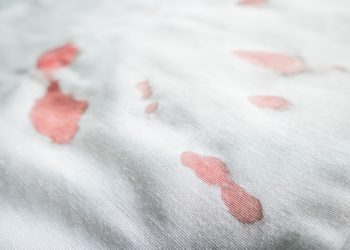 Blutflecken lassen sich meist gut mit Hausmitteln beseitigen, allerdings sollten die Mittel abhängig von dem verunreinigtem Material ausgewählt werden. (Bild: gamelover/fotolia.com)