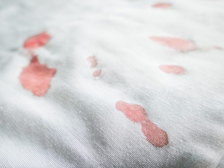 Blutflecken entfernen - Sofa, Jeans, Teppich: Die besten ...